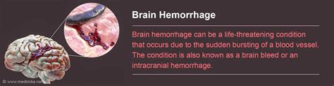 Brain Hemorrhage Intracranial Hemorrhage Glossary