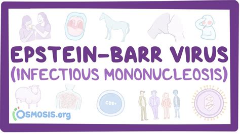 Epstein Barr Virus Infectious Mononucleosis Video Causes And Meaning