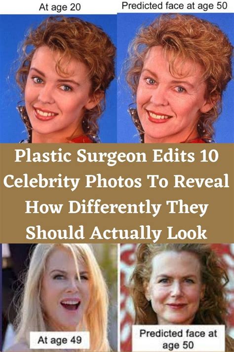 Plastic Surgeon Edits 10 Celebrity Photos To Reveal How Differently