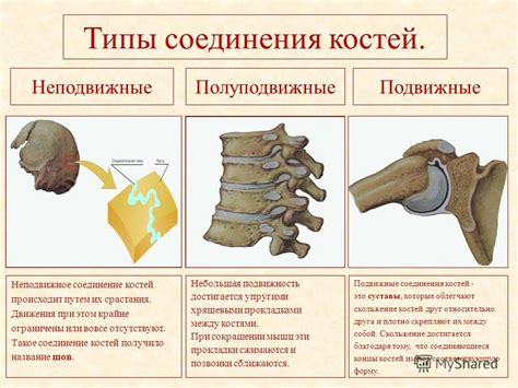 Соединение Костей фото