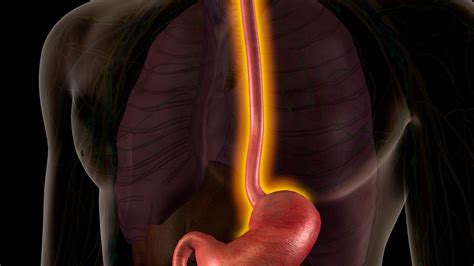 Barrett S Esophagus Symptoms Causes And Prevention Dr Satpal Virk