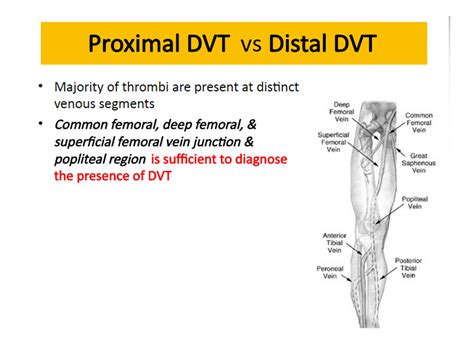 BÀi SoẠn VỀ SiÊu Âm ChẨn ĐoÁn Acute And Chronic Dvt And Ultrasound Us