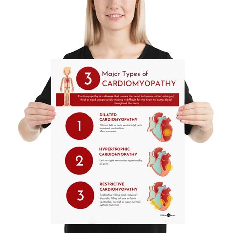 Major Types Of Cardiomyopathy Infographic Poster Etsy