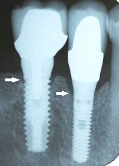 でおすすめアイテム。 The Fabric Of The Modern Implantology その他 Ippsdkuacth