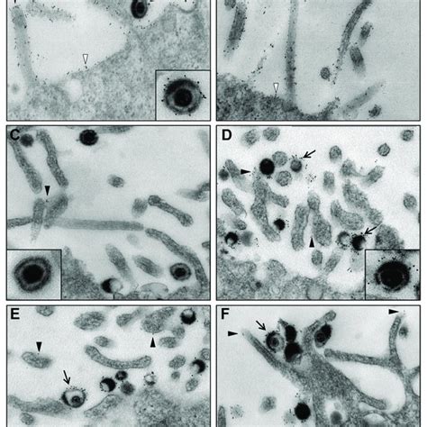 Expression Of MgG Of HSV 2 At The Surface Of Infected Cells HaCaT