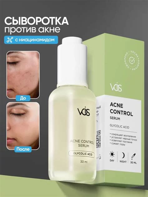 Сыворотка для лица от прыщей и акне с ниацинамидом 30 мл VOIS купить по ...