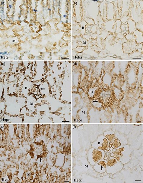 Light Micrographs Illustrating In Situ Immunolocalization Of Ribulose