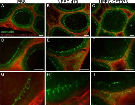 Immunofluorescent Staining Of The Tight Junction Protein Occludin