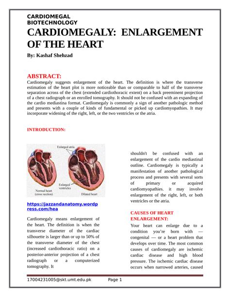 Cardiomegaly Causes