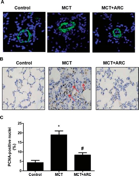 ARC Inhibits The Proliferation Of PASMCs In MCT Induced Pulmonary