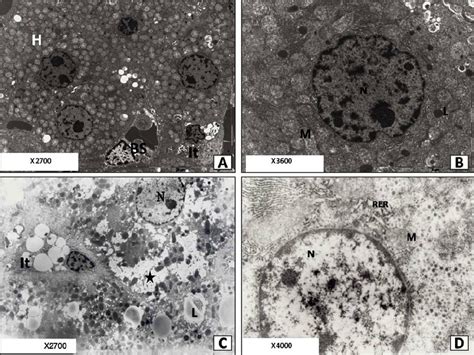 A An Electron Microscopic Micrograph Of Control Liver Showing Intact Download Scientific