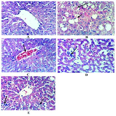 Photomicrographs Of Rat Liver Sections H And E X 400 A Group 1