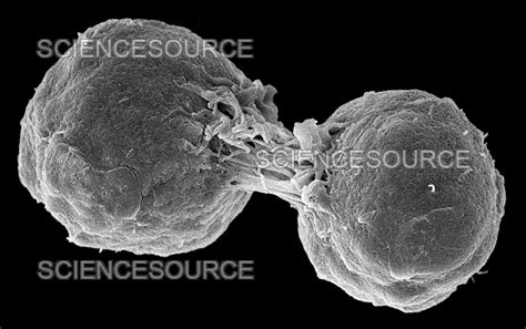 Dividing Lymphoma Cancer Cells Sem Stock Image Science Source Images