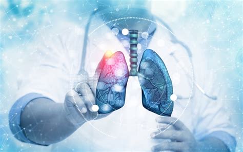 Lung damage found in 11% of severe COVID survivors