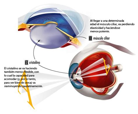 Venta Presbicia Ocular En Stock