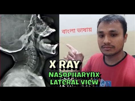 technique  nasopharynx  ray radiology  ray nasopharynx lateral