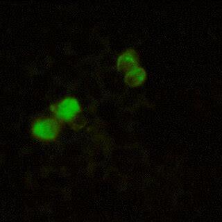 Expression of green fluorescent protein (GFP) by Δpre-M/E-GFP 48 hours ...