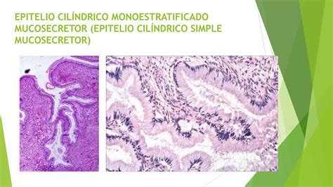 Tejido Epitelial De Revestimiento Y Glandular Ppt