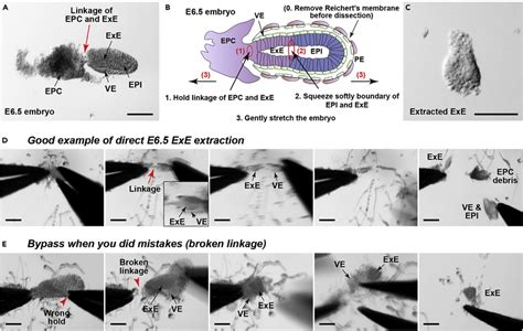 ExE Extraction From E6 5 Embryo A Structure Of E6 5 Conceptus If You