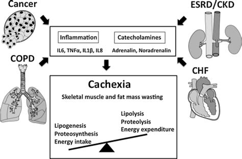 Molecular Mechanisms Of Cachexia Typical Metabolic Changes Associated