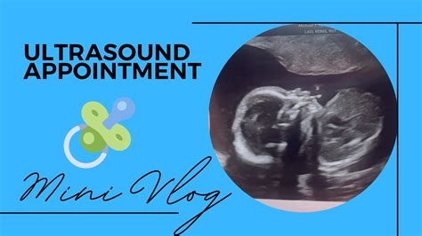 Mini Vlog 20 Week Ultrasound Youtube