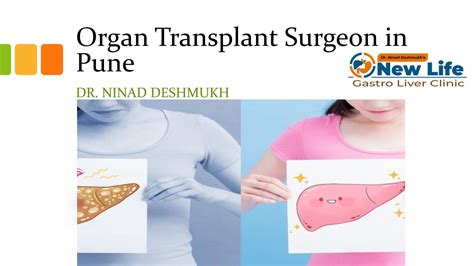 Liver Transplant Surgeon In Pune Liver Transplant In Pune By Liver Transplant In Pune Issuu