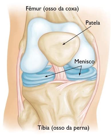 Menisco Disc Ide Dr Leonardo Rocha Thomaz