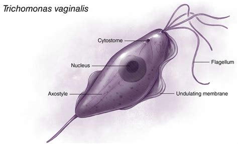 Trichomoniasis Causes Symptoms In Men And Women Diagnosis And Treatment