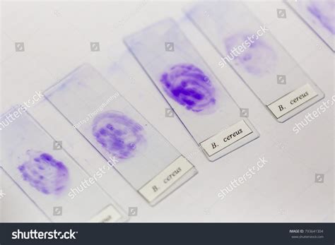 Technique Smear Preparation Microbiology Education Lab Stock Photo