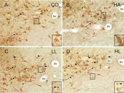 Photomicrographs Illustrating C Fos Immunopositive Nuclei And