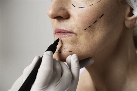 Thread Lifting Melbourne An Effective Non Surgical Facelift Option