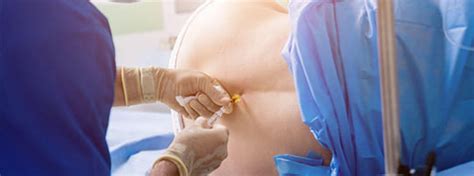 Epidural Vs Cortisone Injections For Accident Pain L Impact Medical