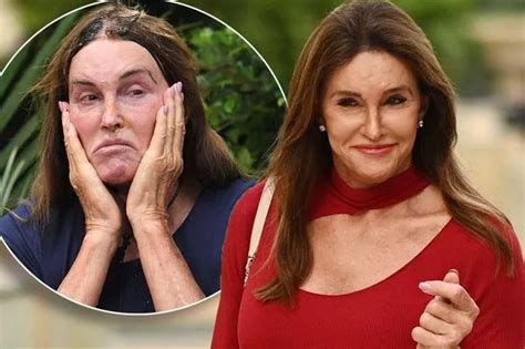 Caitlyn Jenner S Changing Face From Fillers To Boob Jobs As She Waved
