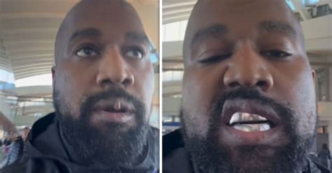 Kanye West Sparks Health Concerns With Lip Growth After Titanium