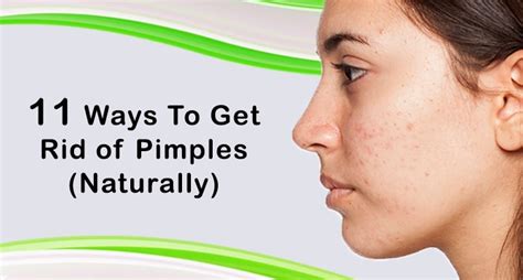 How To Treat Acne Dr Venus