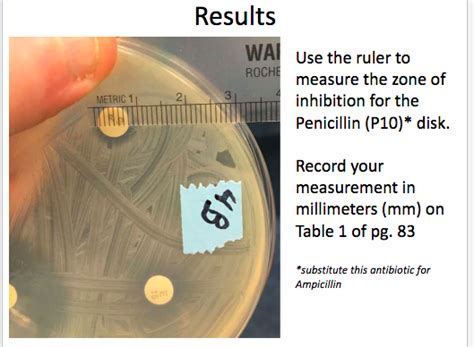 Solved Measuring Sensitivity To Antimicrobial Agents Chegg