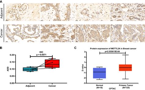 METTL2A Protein Expression In BRCA Tissues A Immunohistochemical