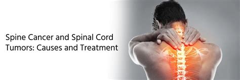 spine cancer  spinal cord tumors   treatment