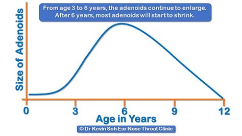 Enlarged Adenoids, Adenoiditis and Adenoid Surgery in Children