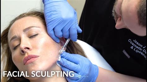 Facial Sculpting Treatment Facial Sculpting With Revanesse Versa