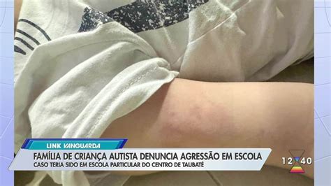 Pai De Crian A Autista Denuncia Agress O Ao Filho Em Escola Particular