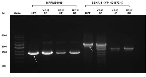 Ultrahipf Dna Polymerase Kit Igenebio