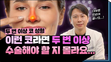 두 번 이상의 코 수술이 필요한 코 딱 알려드림 Ft 마인드성형외과 이영택 원장님 Youtube