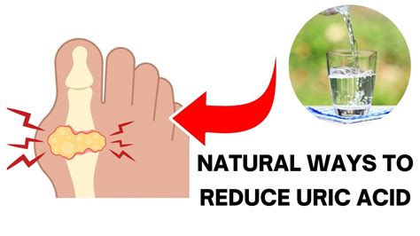 5 Effective Natural Ways To Reduce Uric Acid Levels Youtube