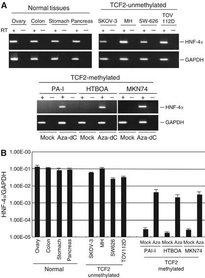 Analysis Of Hnf Mrna Expression A Expression Of Hnf In Cancer