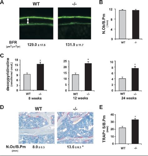 Figure From Amylin Inhibits Bone Resorption While The Calcitonin