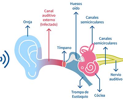 Otitis Aguda Externa Causas S Ntomas Y Tratamiento