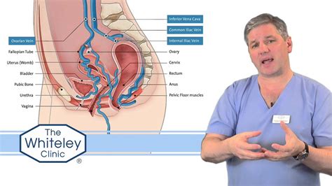 Prominent Pelvic Veins