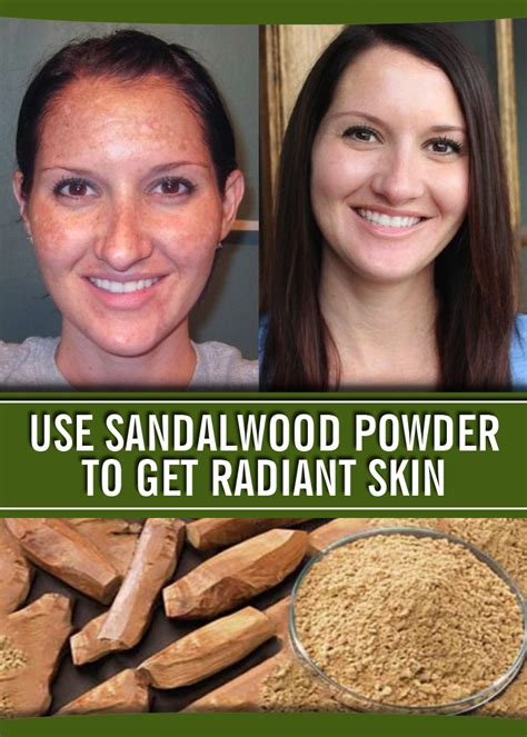 USE SANDALWOOD POWDER TO GET RADIANT SKIN