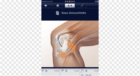 Fisioterapia Terapia De Ultrasonido Terap Utica Terapia De Combinaci N